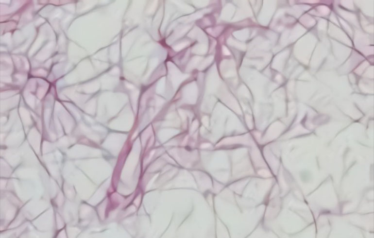 Neumonía causada por Legionella pneumophila | Transmisión y factores de riesgo