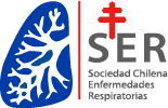 SER