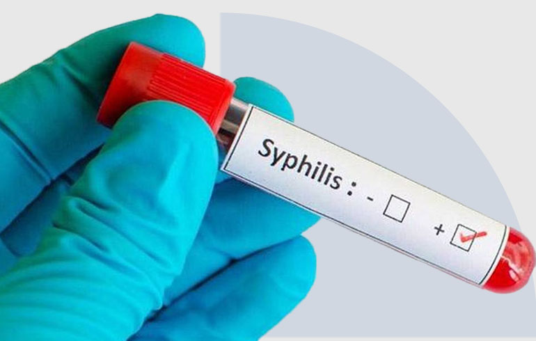 Sífilis y test no treponémicos
