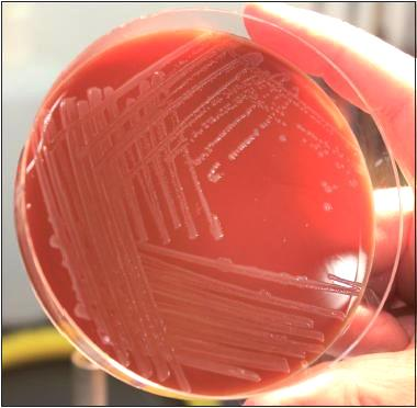 Listeria monocytogenes