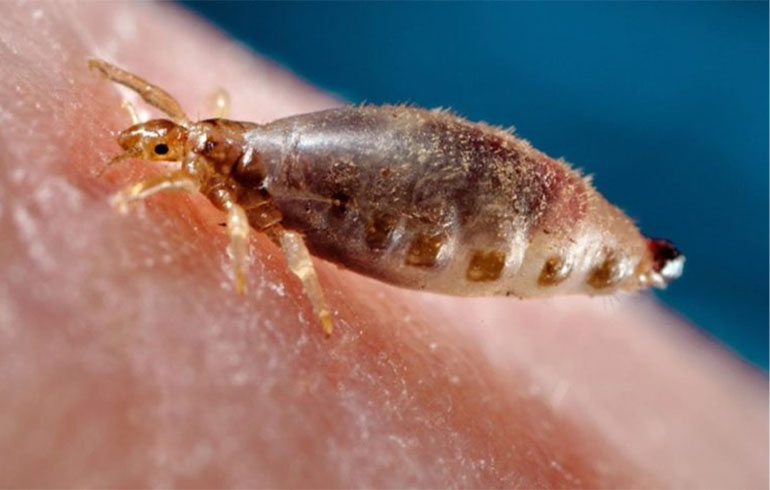 Tifus de los matorrales, una enfermedad emergente en Chile