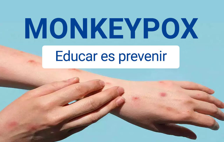 MONKEYPOX – Educar es prevenir