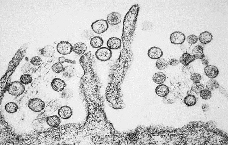 HANTA VIRUS, ¿Qué hacer en atención primaria de salud?