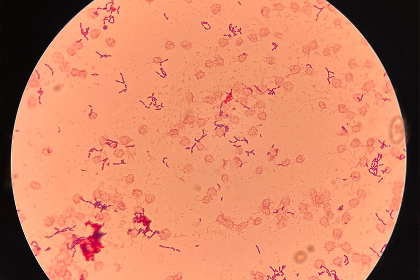 Streptococcus pyogenes