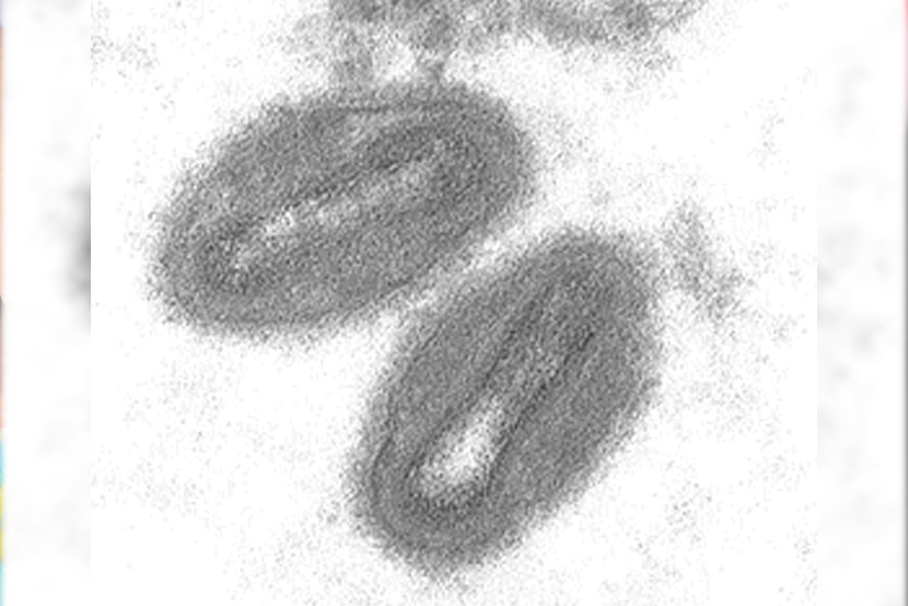Monkeypox