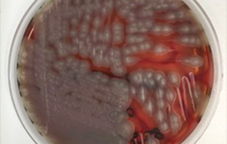 Retrato Microbiológico Bacillus cereus