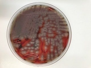 Retrato Microbiológico Bacillus cereus