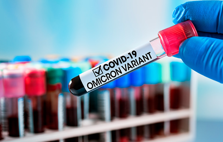 Resumen y consideraciones en relación a «Plan de manejo de Coronavirus en Chile frente a nueva variante ÓMICRON»