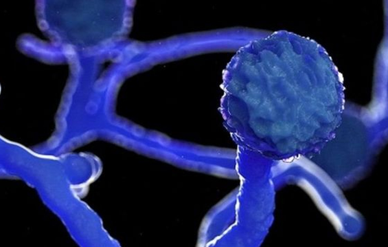 Comentarios en relación a las «Infecciones Fúngicas en pacientes COVID-19: Hongos negros y hongos verdes»