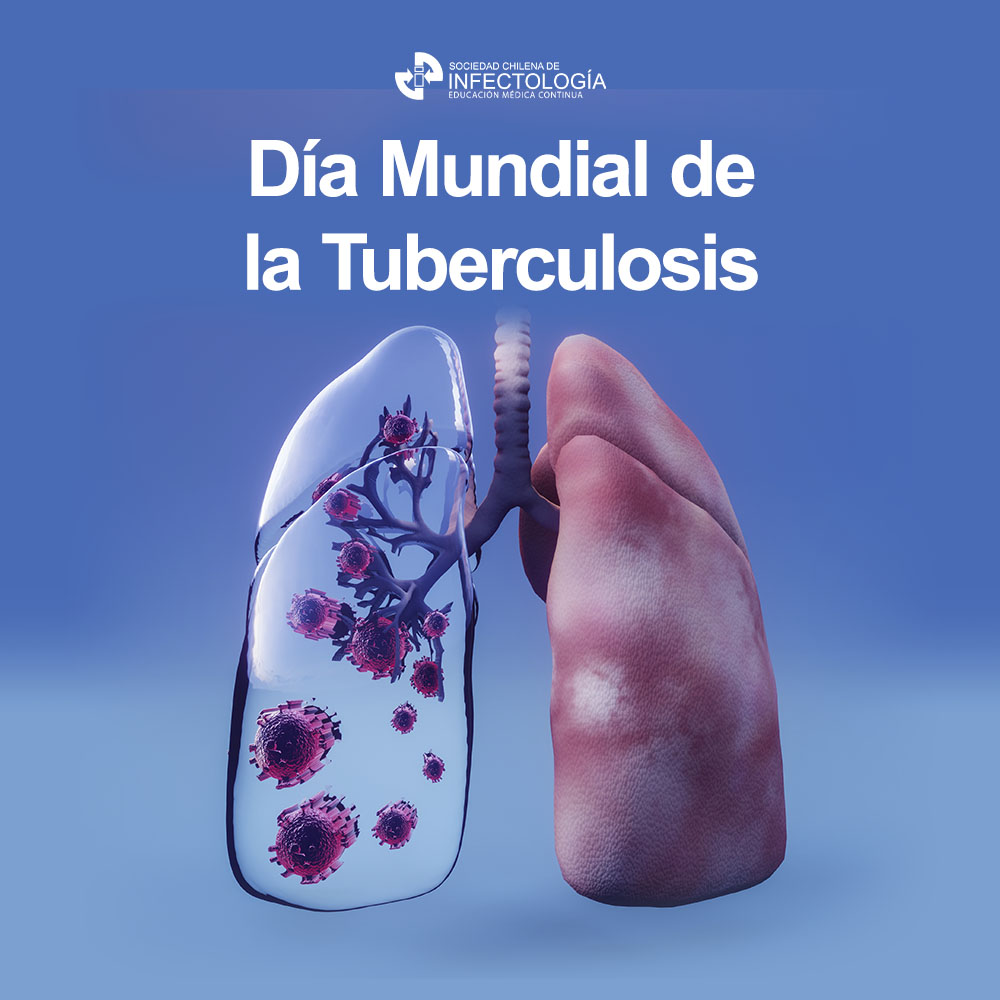 Día Mundial de la Tuberculosis