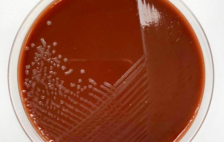Retrato microbiológico – Haemophilus influenzae