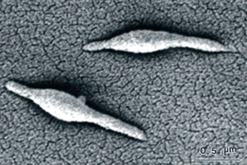 Mycoplasma pneumoniae