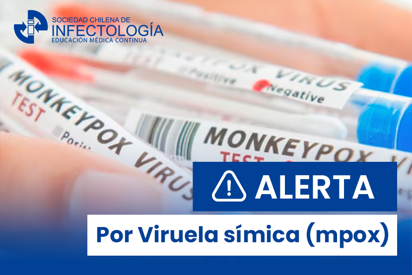 Alerta por Viruela símica (mpox)