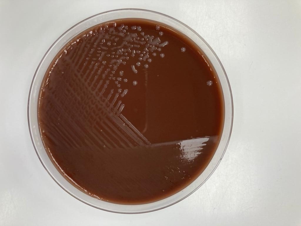 Retrato microbiológico – Haemophilus influenzae
