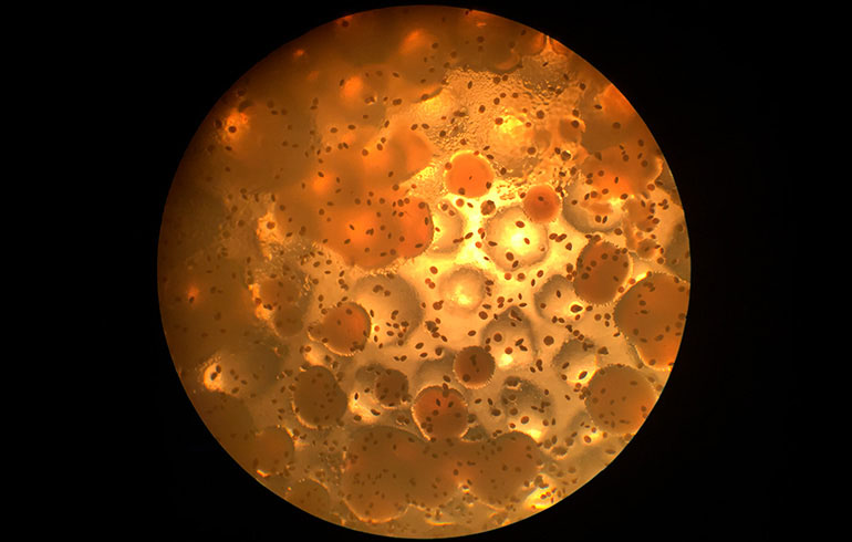 ¿Qué es y cómo estudiar el complejo Burkholderia cepacia?